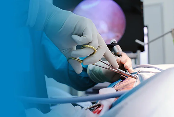 Laparoscopic & Operative Hysterectomy