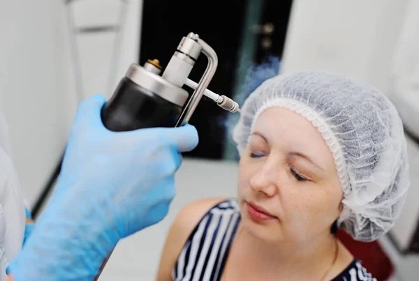 Cryosurgery