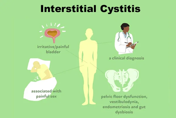 Interstitial Cystitis