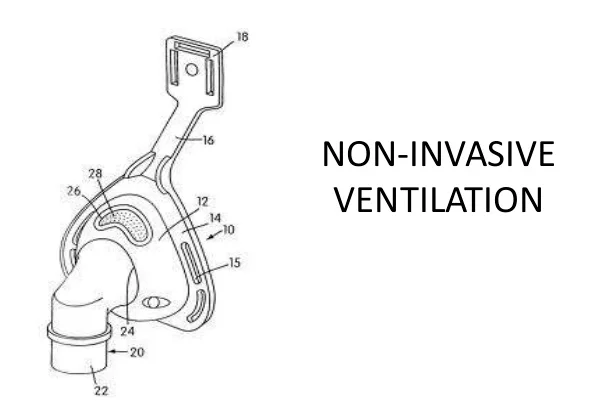 Noninvasive Ventilation