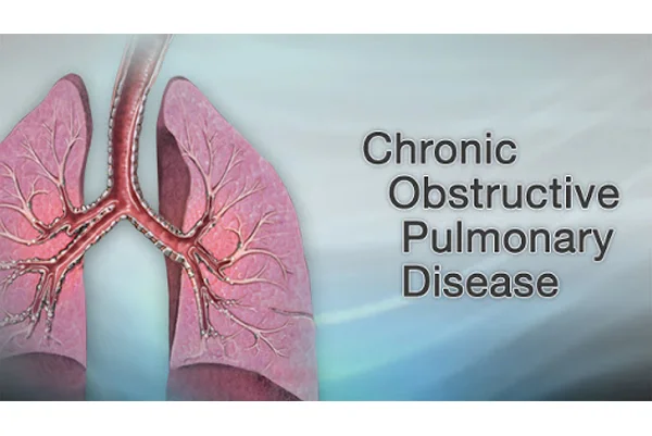 Chronic Obstructive Pulmonary Disease