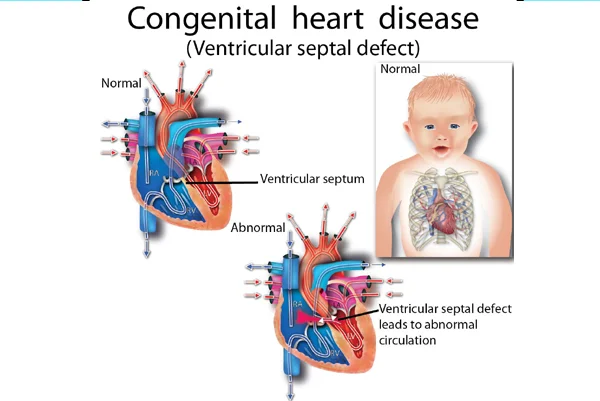 Cardiology OPD