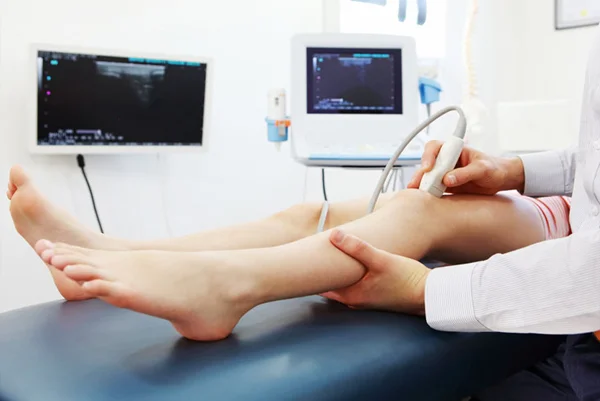Limb Doppler Ultrasound